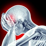 x-ray image human head with headache pain